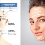 Reinforcement of the face with gold threads in cosmetology