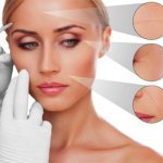 Биоревитализация–процедура омоложения лица. Препараты, цена, отзывы, фото до и после