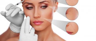 Biorevitalization is a facial rejuvenation procedure. Drugs, price, reviews, before and after photos