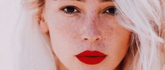 Блефаропластика Насти Ивлеевой