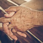 c glav - Черные пятна на руках