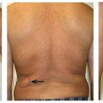 Что из себя представляют черные точки на теле