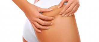 Эффект от проведения озонотерапии при целлюлите