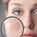 facelift with Galina Dubinina