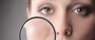 facelift with Galina Dubinina