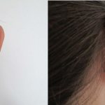 ear shape and character