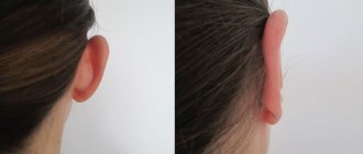 ear shape and character