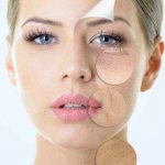 hyaluronic acid on lips: harm and benefit