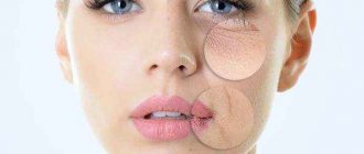 hyaluronic acid on lips: harm and benefit