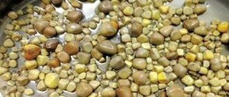 Cholesterol stones from the gallbladder