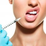 Инъекция филлера в губы
