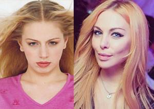 Известна певица двухтысячных Саша Проджект до и после неудачной пластики лица фото