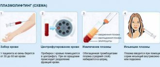 как делают плазмолифтинг