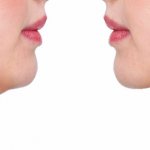 How to remove a double chin quickly and effectively in a week