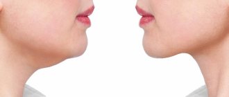 Как убрать второй подбородок быстро и эффективно за неделю