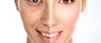 When and why does skin start to age?