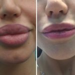 beautiful lips