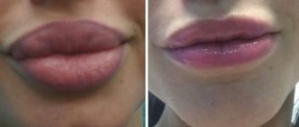 beautiful lips