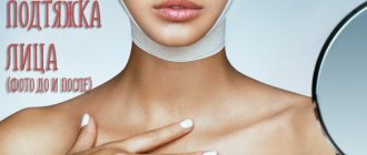 Circular facelift. Reviews, cost, photos before and after surgery