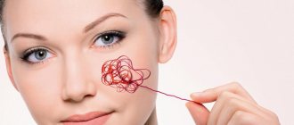 Купероз на лице - фото стадий болезни и методы лечения