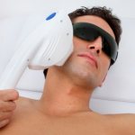 laser hair removal for beard