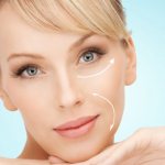 therapeutic result after cryolifting