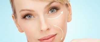 therapeutic result after cryolifting