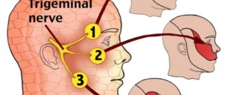 Treatment of facial asymmetry
