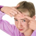 лечение угревой сыпи у подростков