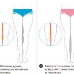 липофилинг голеней