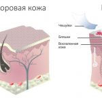 Мази от раздражения на коже у взрослых на лице, руках, теле, в интимных местах. Цены и отзывы