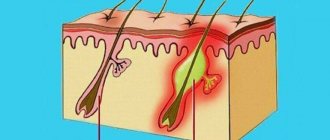 Small rash on the forehead in an adult: causes of the rash in women and men