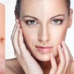 мезодиссолюция отзывы