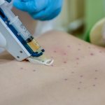 Мезотерапия для позвоночника: как выглядит, медикаменты, рецепты народной медицины, что это такое