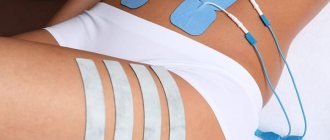 Myostimulation of the body