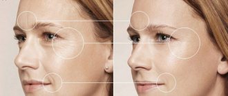 Wrinkles before and after applying cream