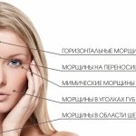 Wrinkles on the face