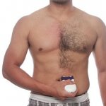 мужская эпиляция