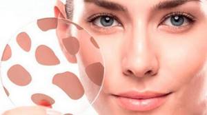 Очищающая маска-пилинг для лица помогает избавиться от гиперпигментации и угревой болезни