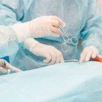 операция по симпатэктомии