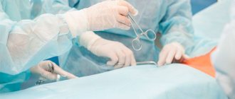 sympathectomy surgery