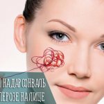 Отзывы на дарсонваль при куперозе на лице