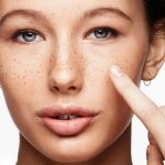 Пигментные пятна на лице. Как убрать, отбелить кожу в домашних условиях. Лечение народными средствами