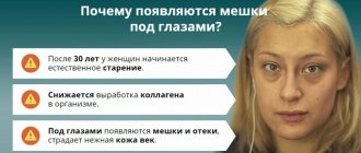 Why do dark circles appear?