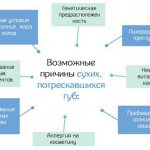 Почему сохнут и трескаются губы у женщин и при беременности. Причины и что делать. Уход и лечение кожи губ