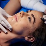 Preparing for plastic surgery
