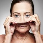 Поговорим о том, что это за процедура, мезотерапия лица.