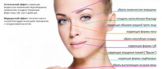 benefits of hyaluronic fillers