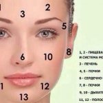 Причинно-следственная связь между локализацией прыщей и заболеваниями