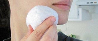 прыщ под носом